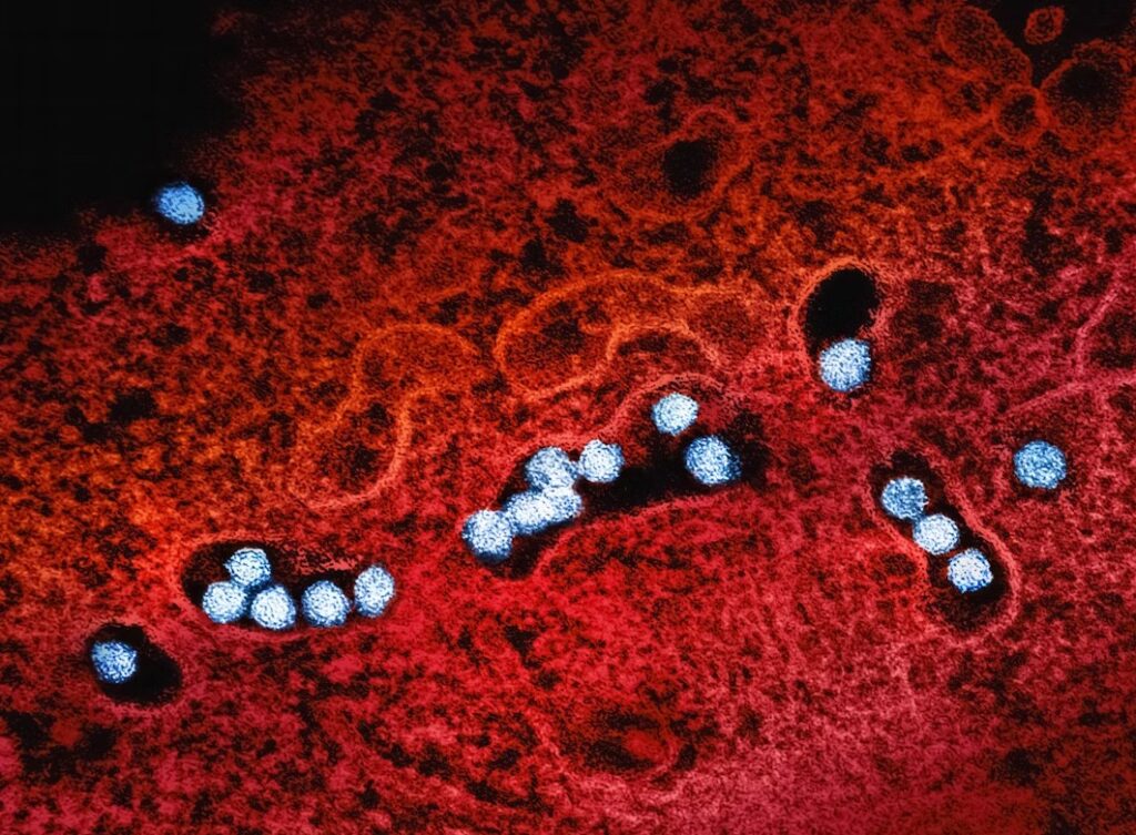 West Nile-virus i infekterad cell.