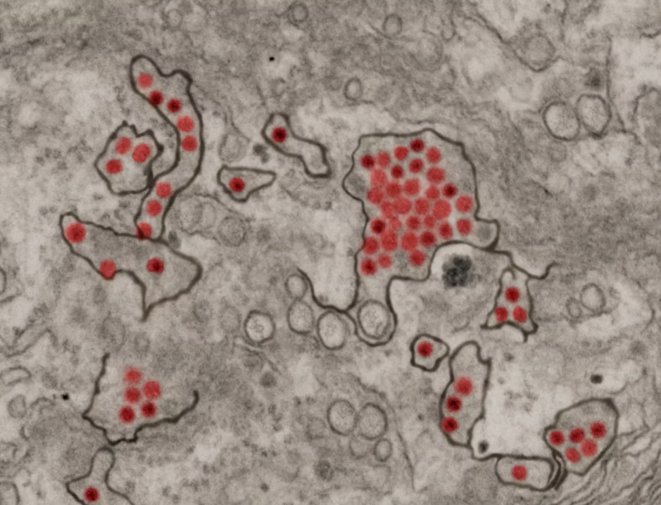 Zika-virus orsakat av mygga.